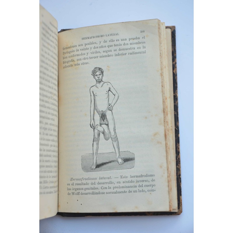 La esterilidad humana y el hermafrodismo