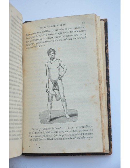 La esterilidad humana y el hermafrodismo