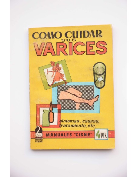 Cómo cuidar sus varices