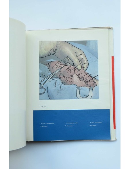 Esófago - Ileo - Colon - Plastica : manuale di tecnica operativa