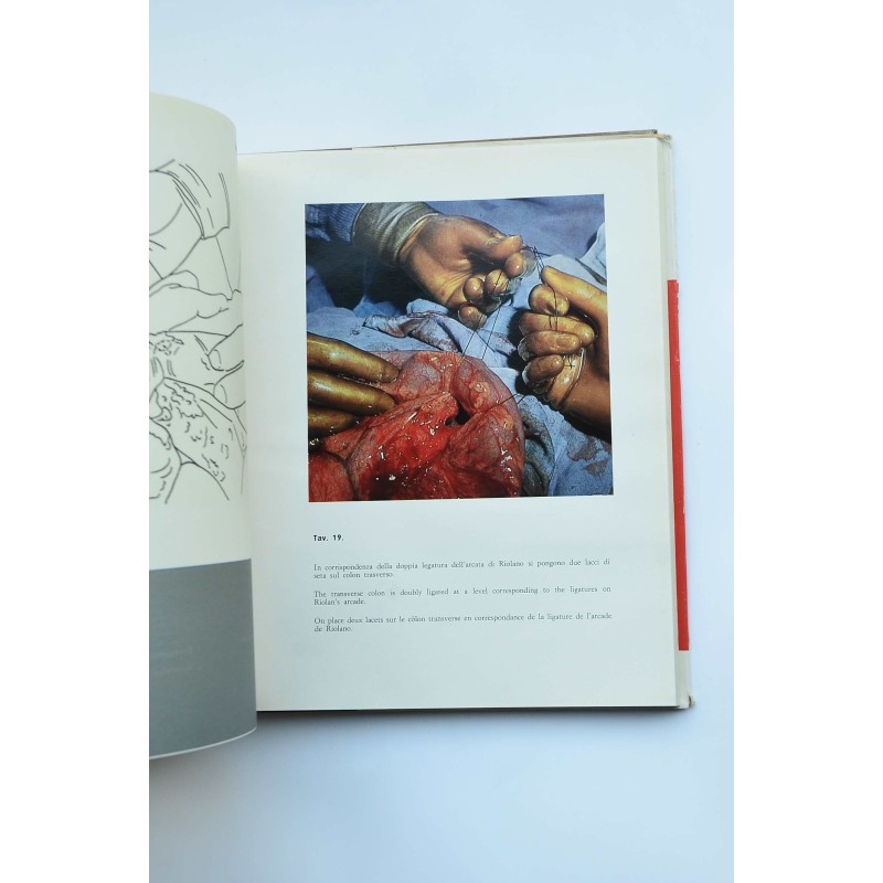 Esófago - Ileo - Colon - Plastica : manuale di...
