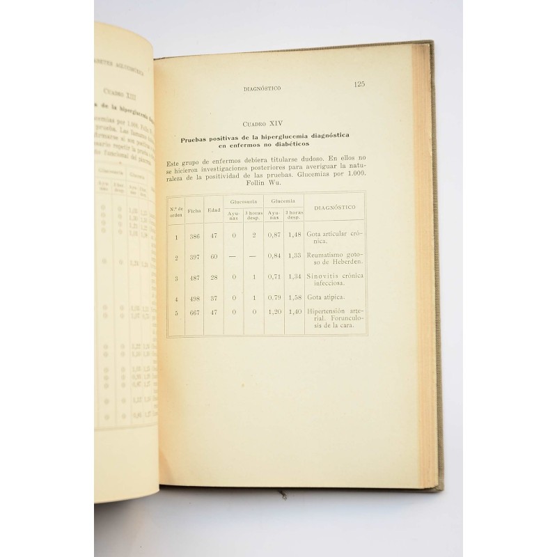 Diabetes aglucosúrica , Diabetes oculta ,...