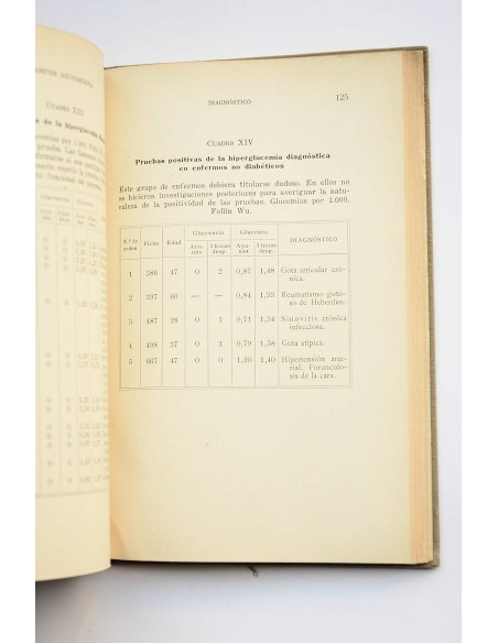 Diabetes aglucosúrica , Diabetes oculta , Diabetes  latente