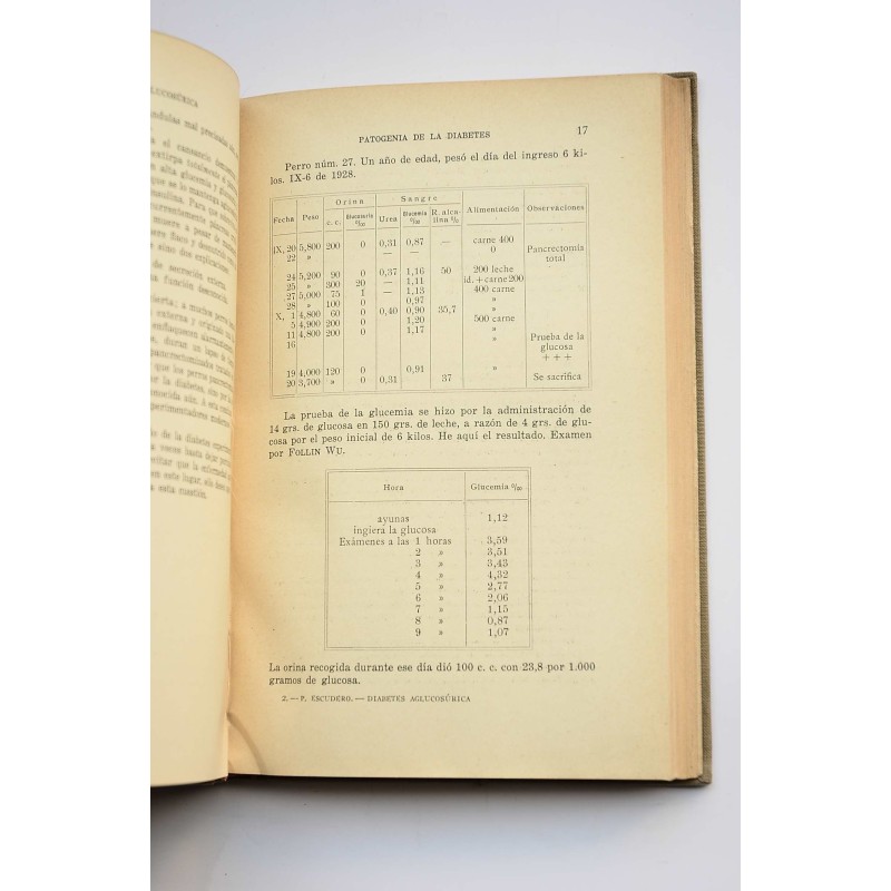 Diabetes aglucosúrica , Diabetes oculta ,...