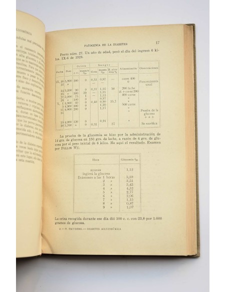 Diabetes aglucosúrica , Diabetes oculta , Diabetes  latente