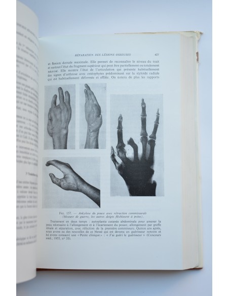 Traité de chirurgie de la main