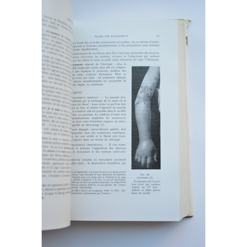Traité de chirurgie de la main
