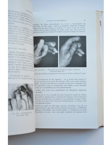 Traité de chirurgie de la main