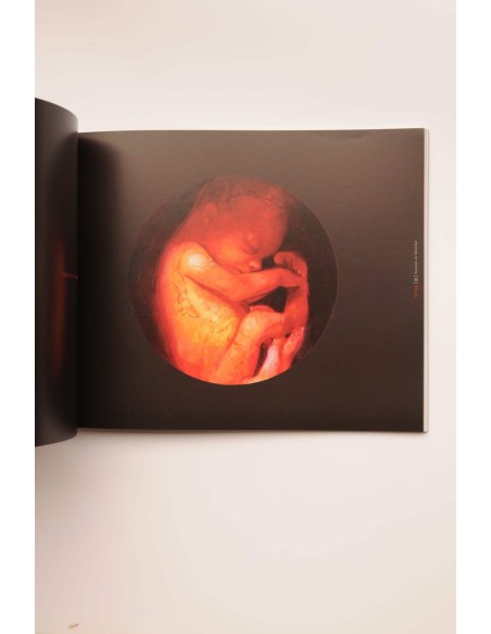 Torregar. Ausencia de identidad