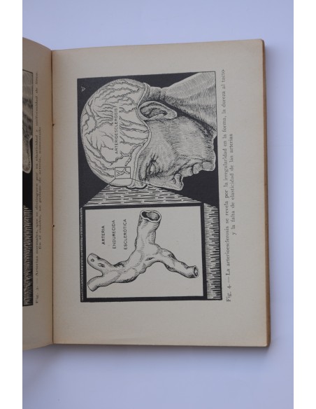 Cómo prolongar la juventud y curar la arterioesclerosis