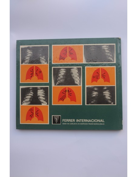 Isoetam. Primera molécula bi - tuberculostática