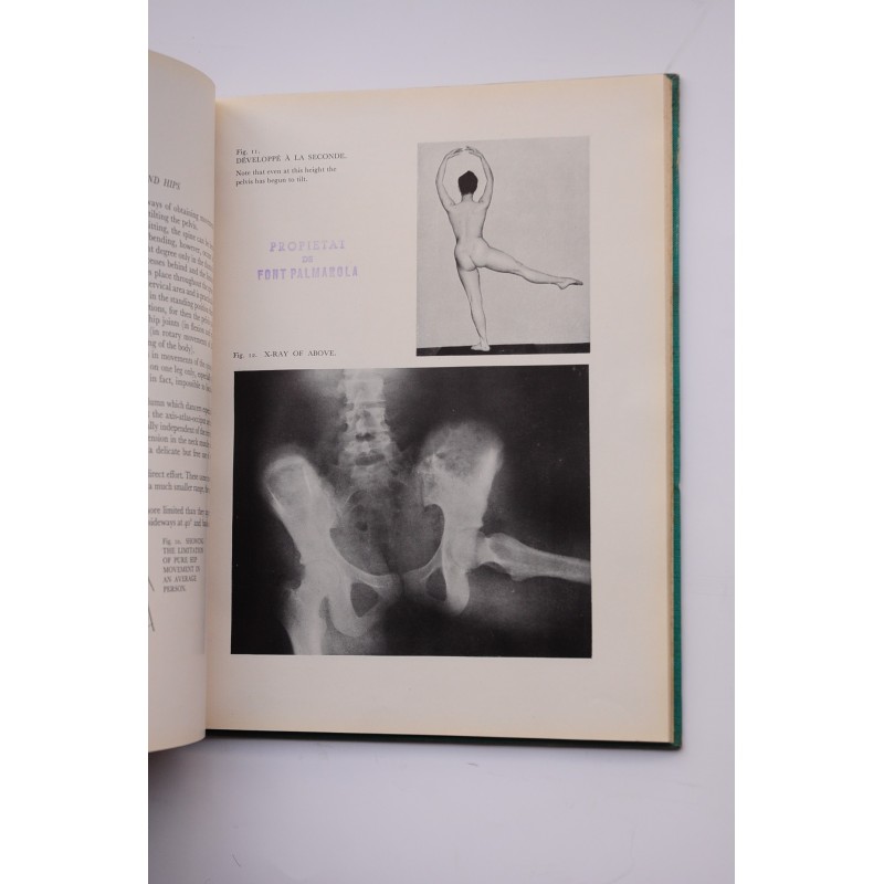 Anatomy and ballet : a handbook for teachers of...