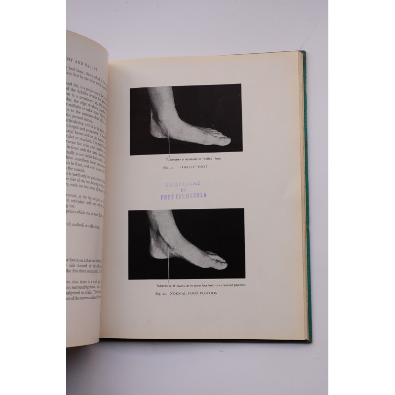 Anatomy and ballet : a handbook for teachers of...