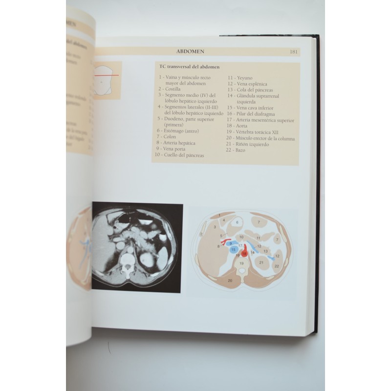 Atlas de anatomía humana. Técnicas de imagen...