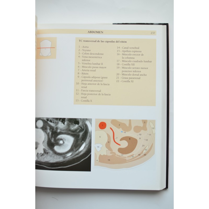 Atlas de anatomía humana. Técnicas de imagen...