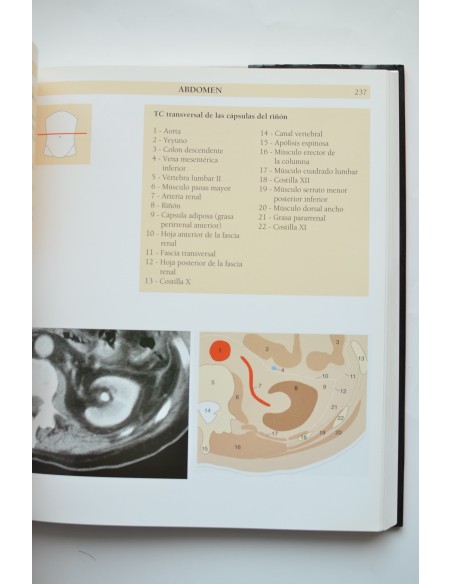 Atlas de anatomía humana. Técnicas de imagen médicas