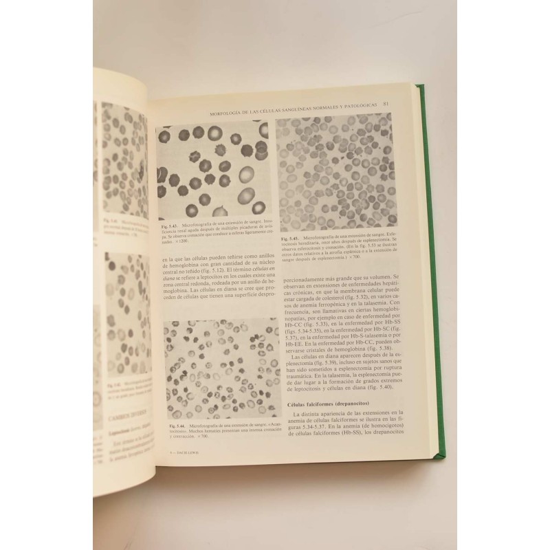 Hematología práctica