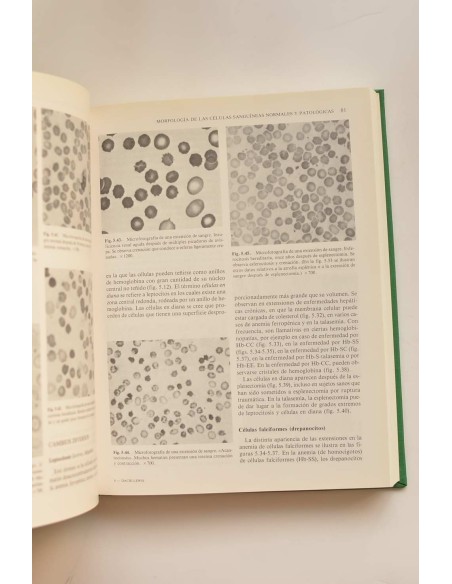 Hematología práctica