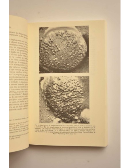 La depresión. Un problema crucial de nuestro tiempo