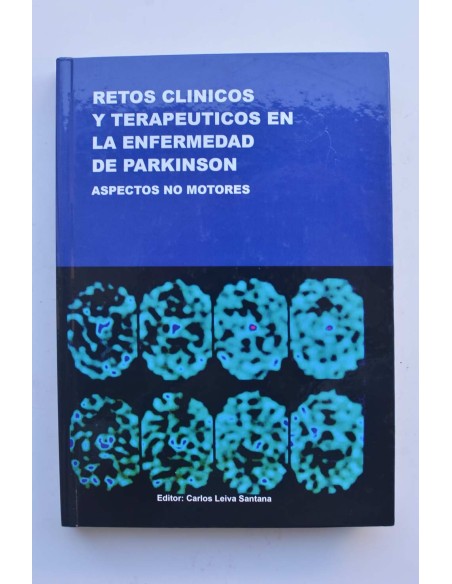 Retos clínicos y terapéuticos en la enfermedad de Parkinson. Aspectos no motores