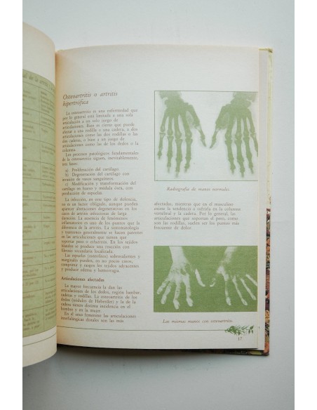 Medicina natural. Reumatismo, artrosis y lumbalgias