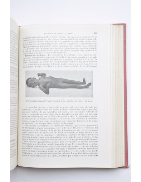 Tratado de enfermedades de los niños