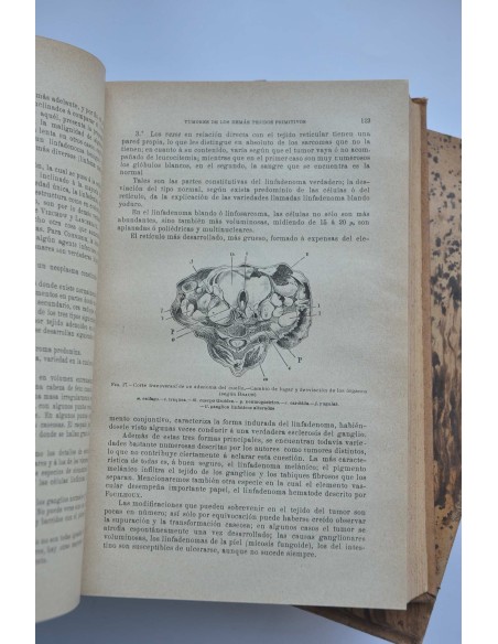 Tratado de patología externa