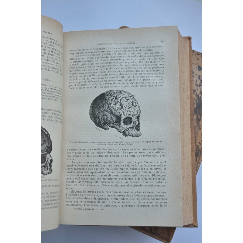 Tratado de patología externa